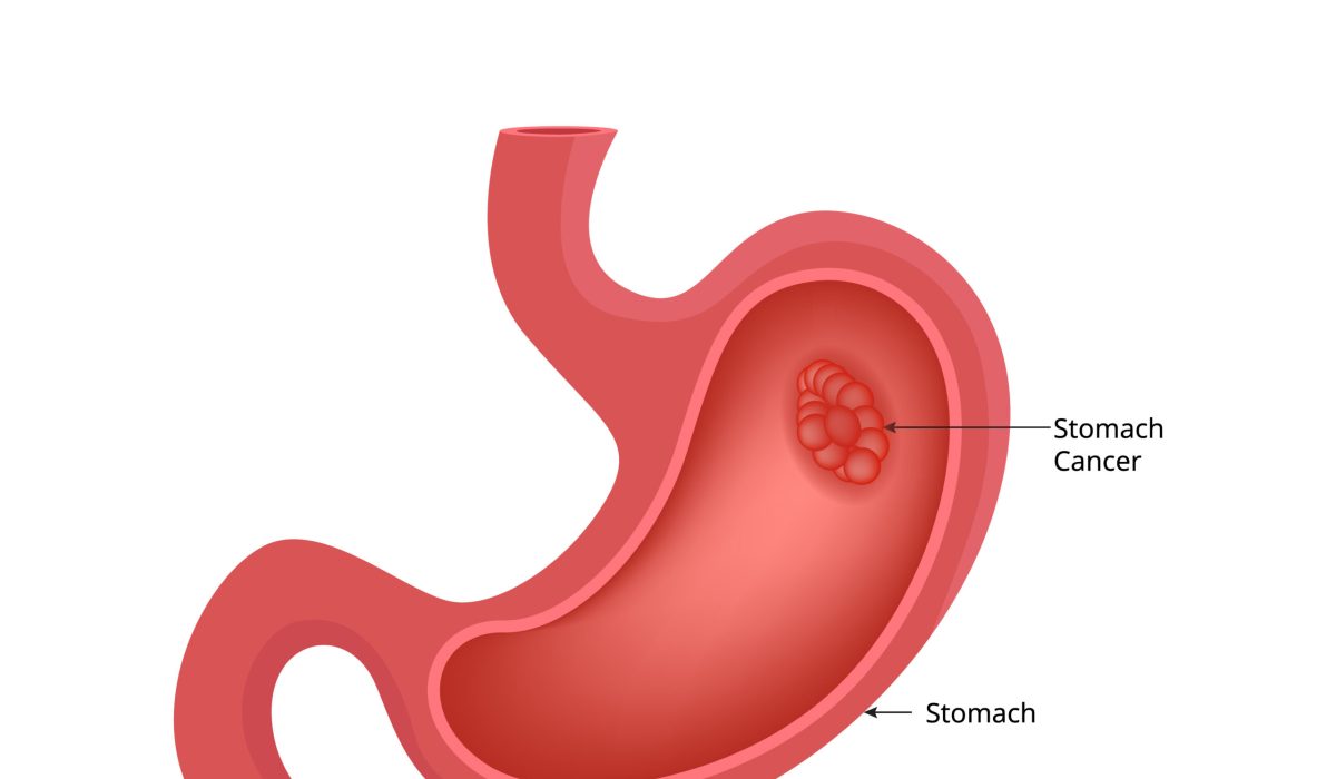 410072967_43427eec-516c-4acc-af04-b37c5eb95d35