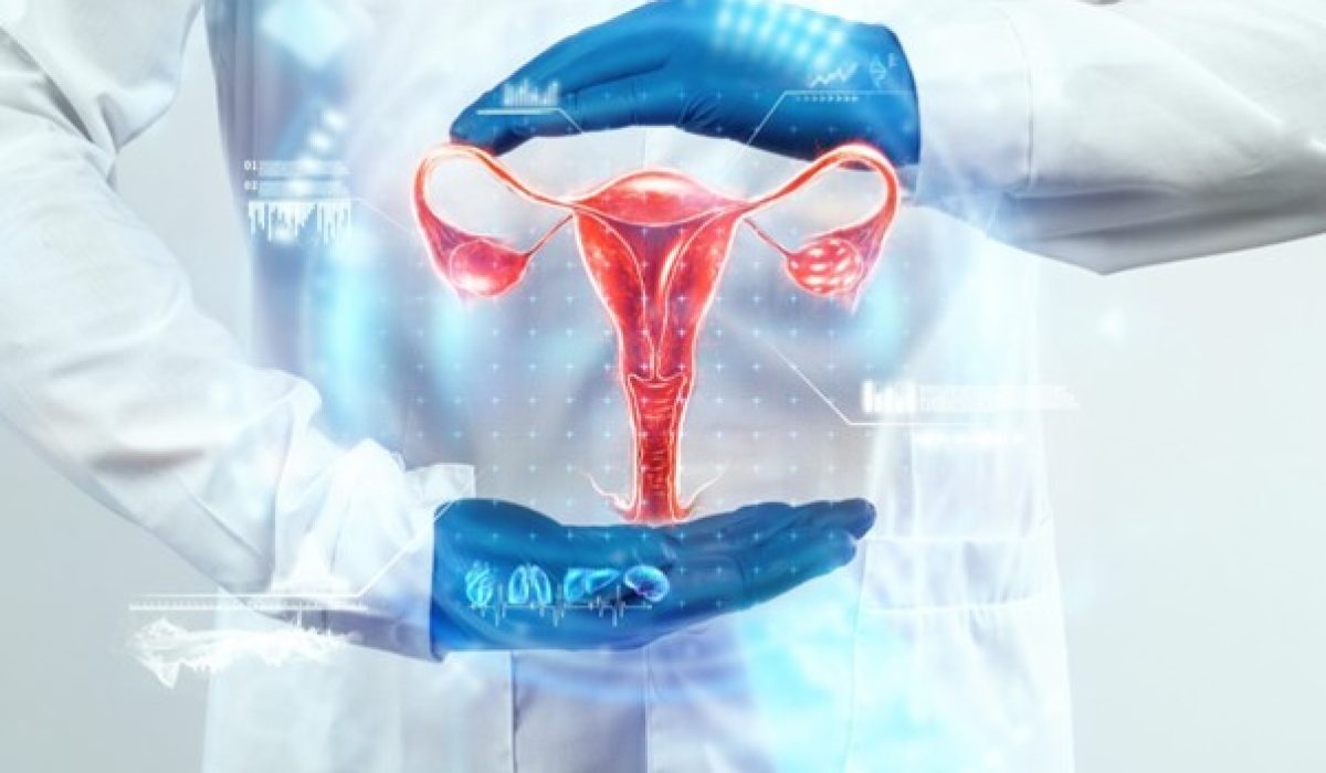 Picture157 Picture157