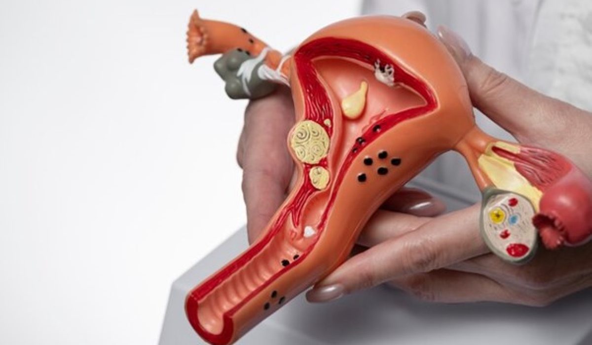 Picture160 Picture160