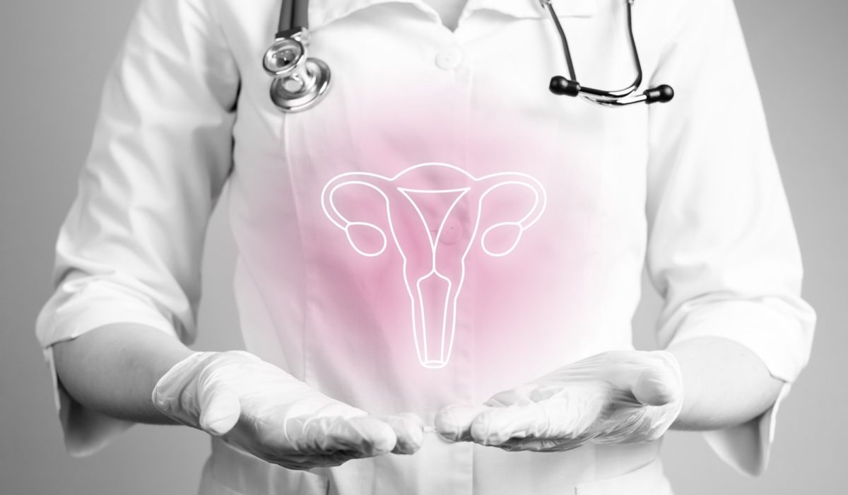 Picture170 Picture170