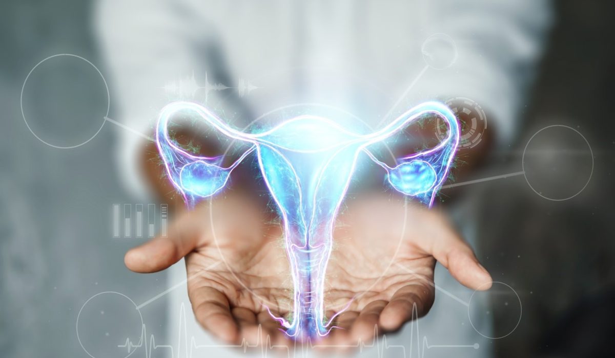 Picture174 Picture174