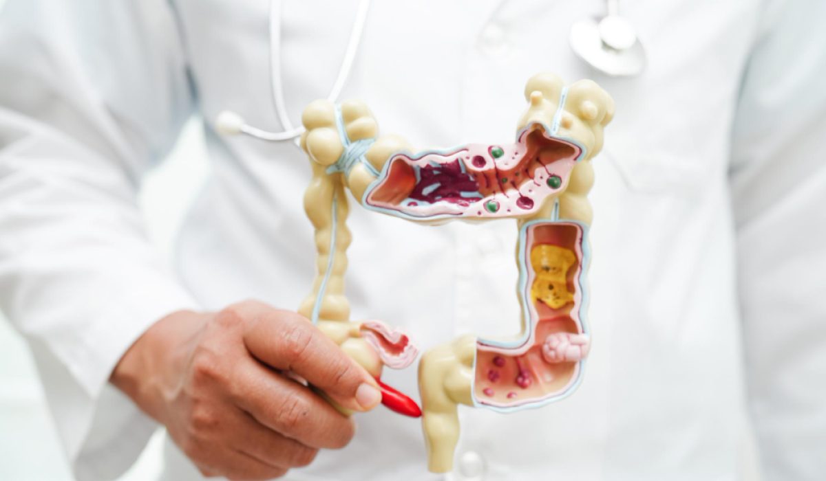 Y25-M07-B-OL-CN20-V3_20250730_v1